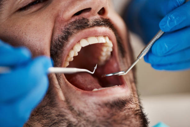 Professional Dental Services in Ironton, OH